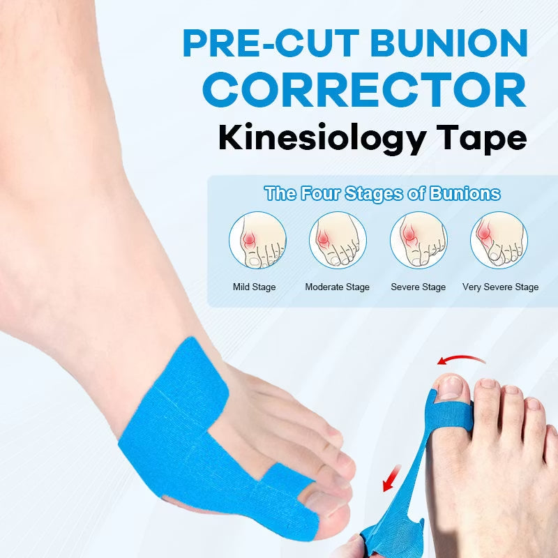 🦶 Bunion Correction Patches: Hospital-recommended—resolve your toe issues completely in just one week, with no recurrence for life!