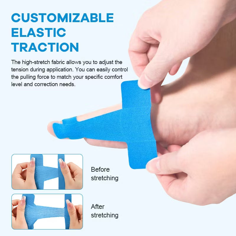 🦶 Bunion Correction Patches: Hospital-recommended—resolve your toe issues completely in just one week, with no recurrence for life!