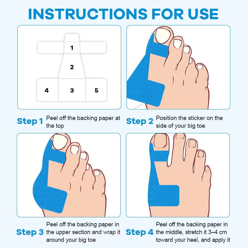 🦶 Bunion Correction Patches: Hospital-recommended—resolve your toe issues completely in just one week, with no recurrence for life!